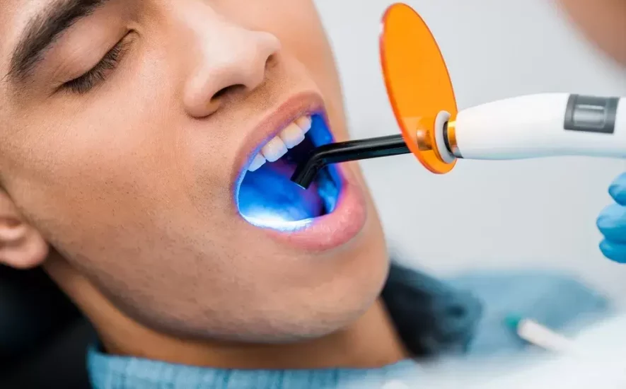 tratamientos-estética-dental