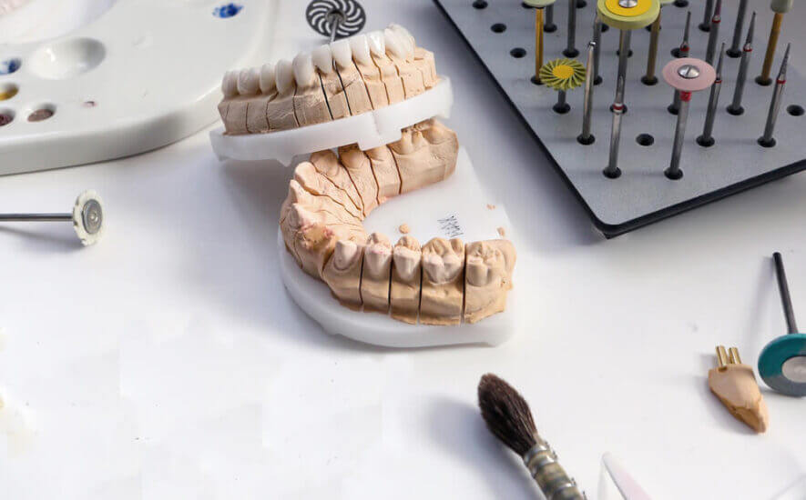 tratamientos-estética-dental-eixample